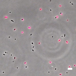 DMSP utilization by marine bacteria