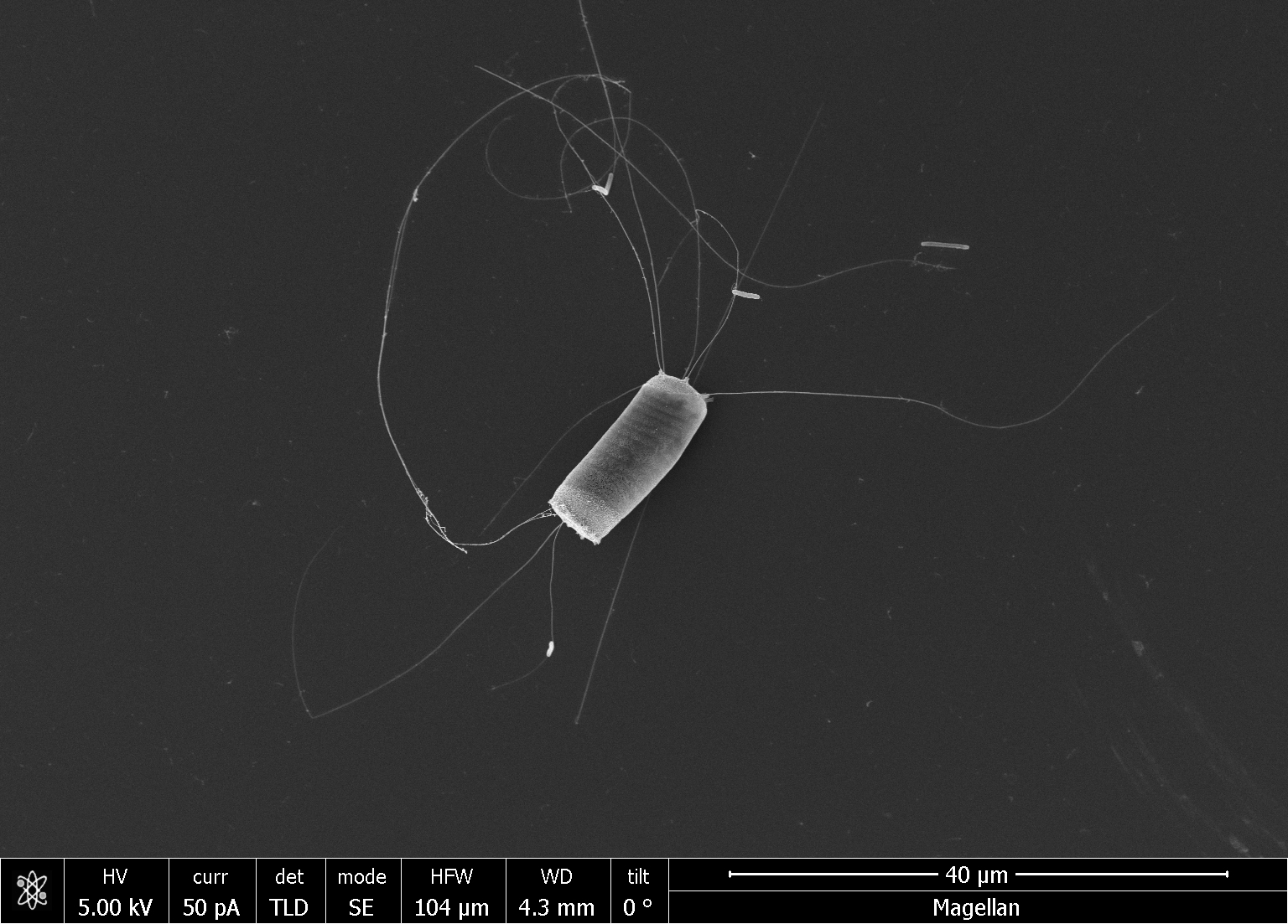 Bacteria attachment to diatom