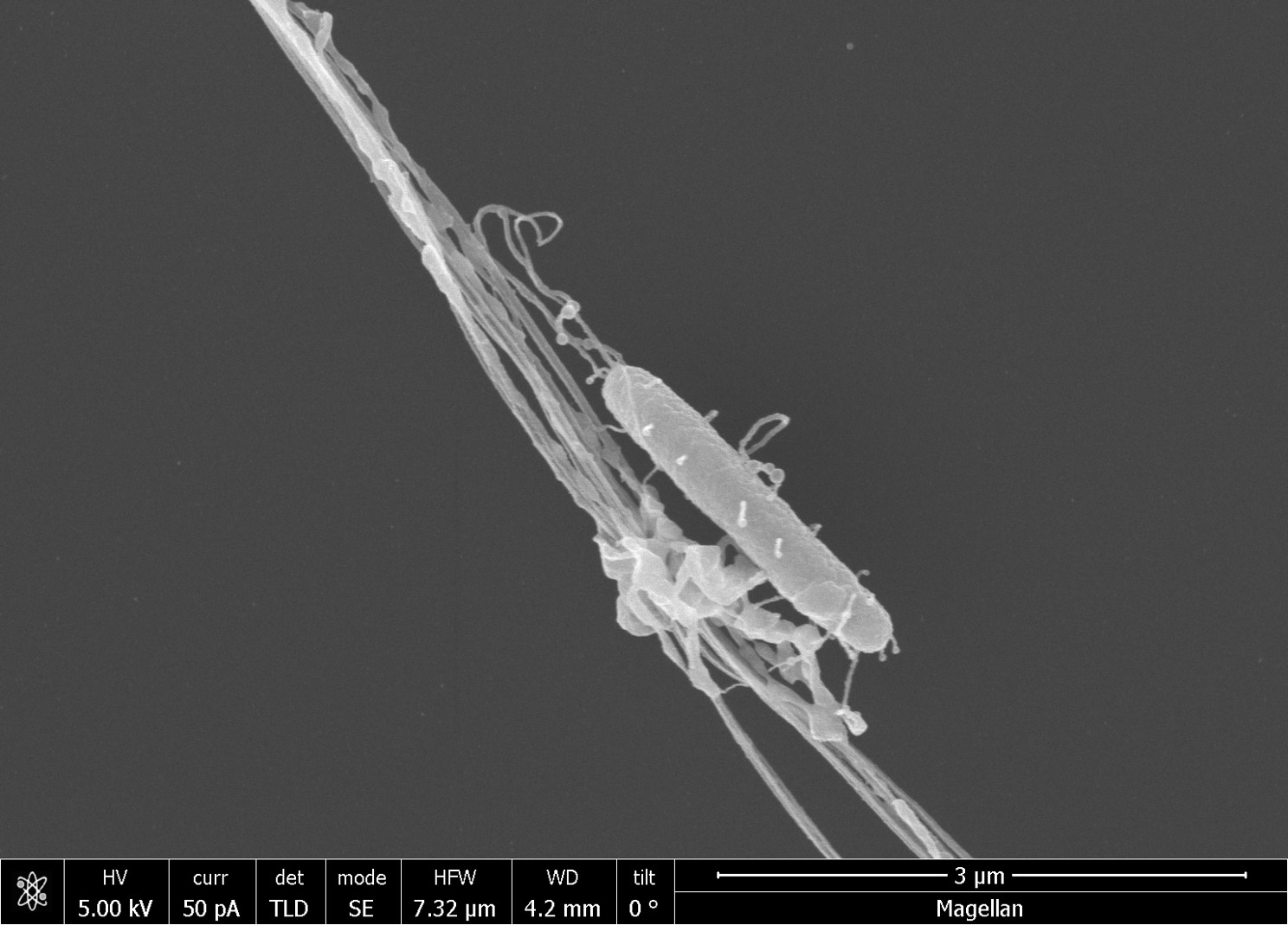 Microscale dynamics of bacteria-spines interactions 